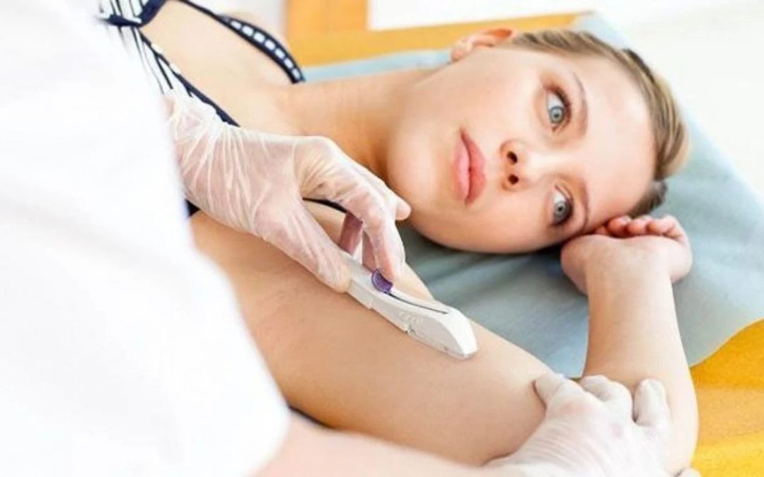 Implante hormonal: tratamento moderno de reposição